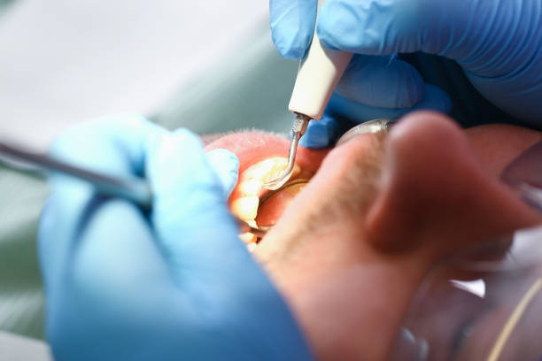 Best Emergency Broken Tooth Repair in Stanton, TX