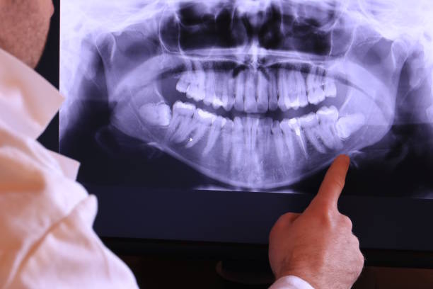 Best Emergency Root Canal Treatment in Stanton, TX