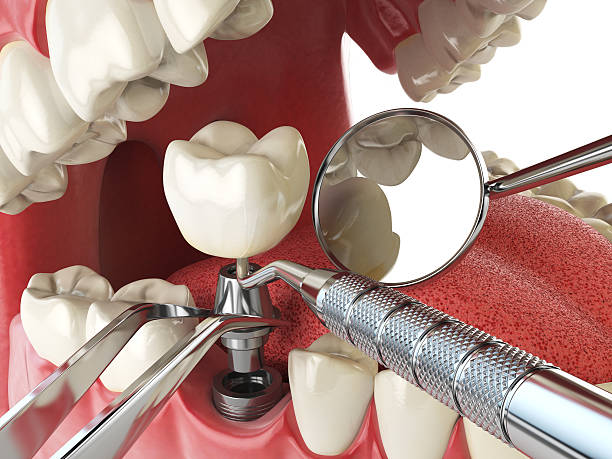 Best Weekend Emergency Dentist in Stanton, TX
